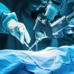 HPB robotic cancer surgery in Vadodara